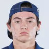Tristan Ryerson